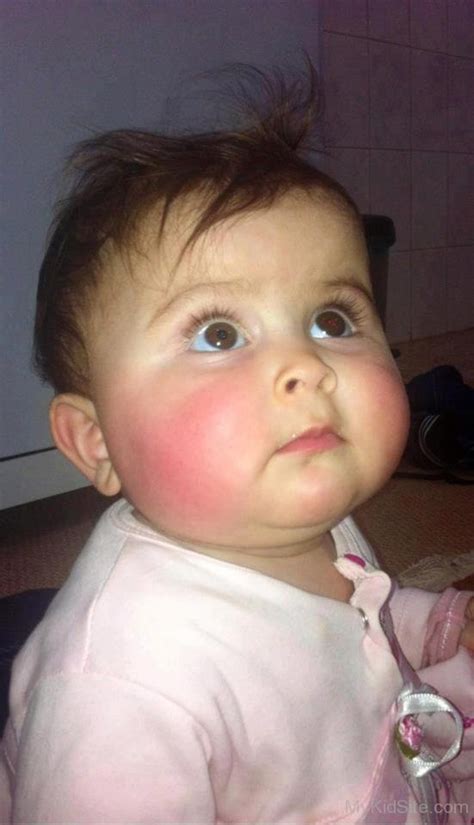 Baby With Red Cheeks