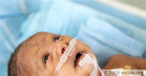 Premature Baby Born With A Hole In The Heart Needs Treatment Milaap
