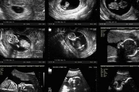 8 Fase Perkembangan Bayi Dalam Rahim Dari Bulan Ke Bulan