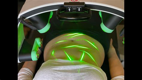 Emerald Fat Loss Laser Exclusively At Holland Health Youtube
