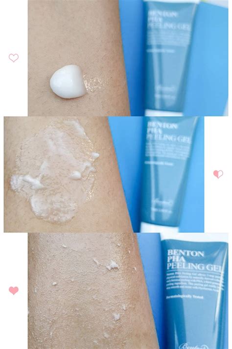 Ugh, yes, your edge control could be the cause of your forehead and hairline acne. BENTON PHA PEELING GEL : THE BEST PEELING GEL FOR ...