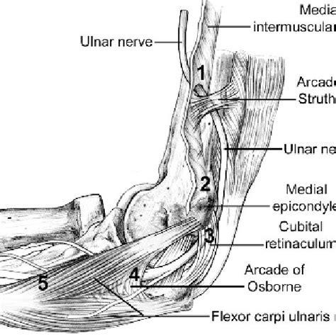 3 A The Ulnar Nerve Typically Lies Posterior To The Intermuscular