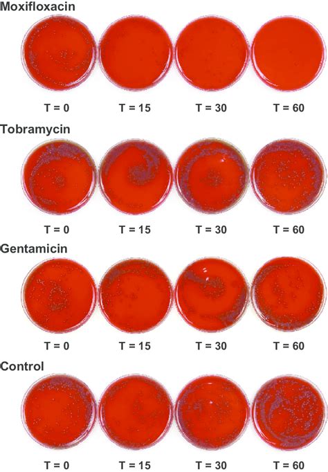 Photographs Of Streptococcus Pneumoniae Mcc 40211 Grown On Blood Agar