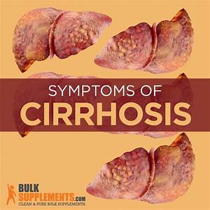 Cirrhosis: Characteristics, Causes & Treatment - BulkSupplements.com Cirrhosis  