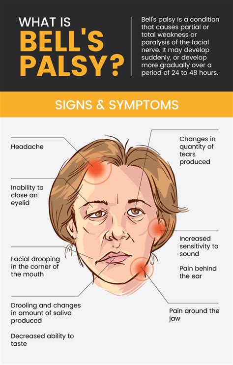 Paralysis Facial Cerebral Palsy Acupuncture Treatment Nashik