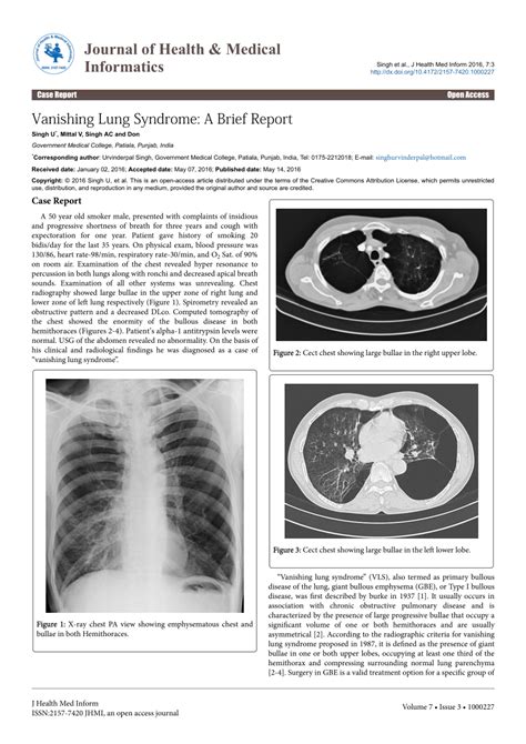 PDF Vanishing Lung Syndrome A Brief Report