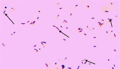 Shows Cells Of Campylobacter Species From Isolate Colony Showing