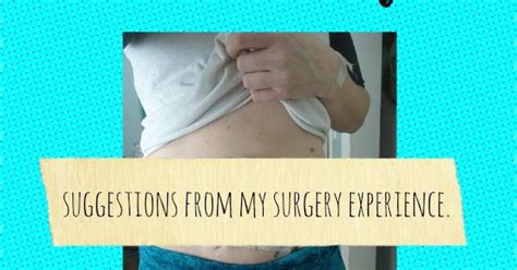 What To Expect During Umbilical Hernia Surgery Recovery Umbilical