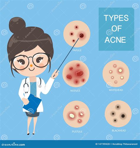 Doctors Recommend Typ Of Acne Stock Illustration Illustration Of
