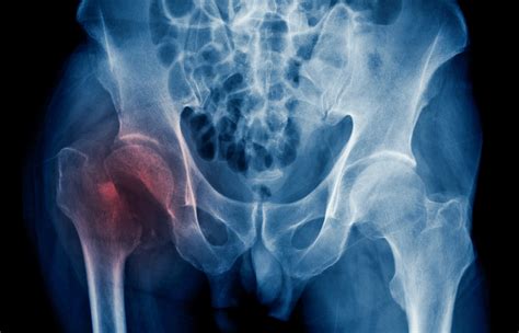 Simple Science: How to Make a Volcano with Kids