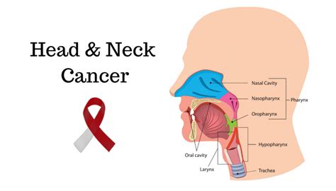 Cancer Types Head And Neck Cancers Nfcr