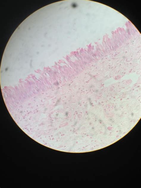 Bottom Of Epiglottis Pseudostratified Ciliated Columnar Epithelium My