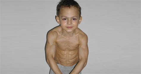 Unvaccinated Muscle Child Going For Glass Cannon Build