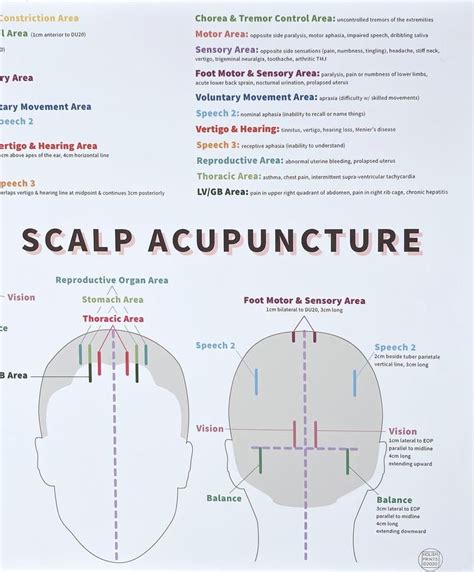 Scalp Acupuncture Points Chart