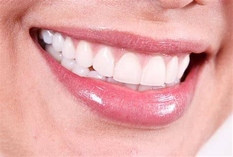 Maintaining Results From Professional Teeth Whitening Treatments Dr