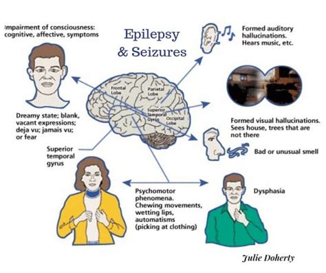 Epilepsy And Seizures The Irritated Brain Identify Causes Triggers Natural Treatments