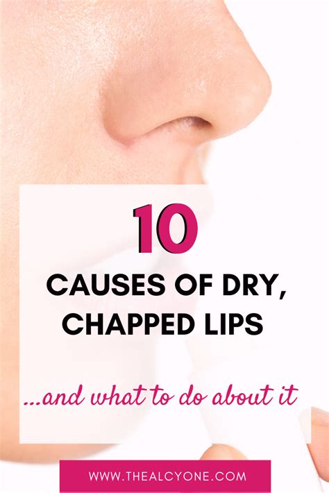 10 Causes Of Dry Chapped Lips And How To Heal Dry Lips