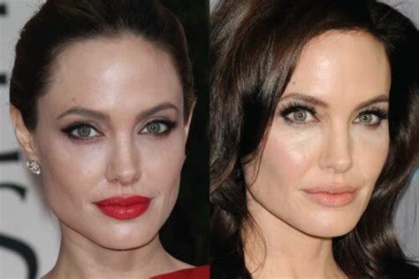 Has Angelina Jolie Had Cosmetic Surgery