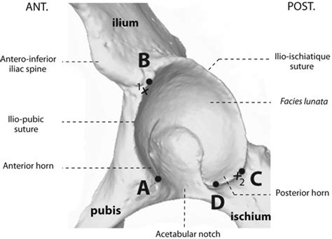 Lateral View Of A Left Acetabulum The Anterior And Posterior Horn Tips