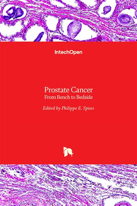 Prostate Cancer From Bench To Bedside Intechopen