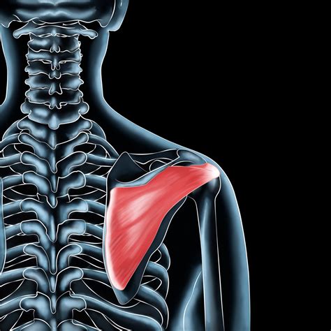Infraspinatus Muscle Injuries Shoulder Strain Solutions