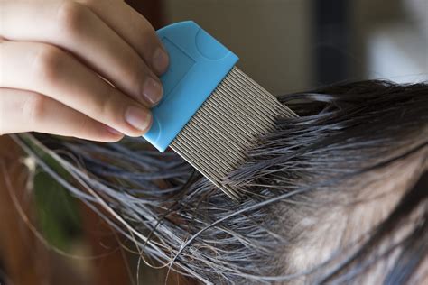The Way Of Lice Everything You Need To Know About Head Lice Slma