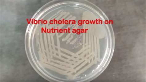 Nutrient Agar With Growth Of Vibrio Cholerae Youtube
