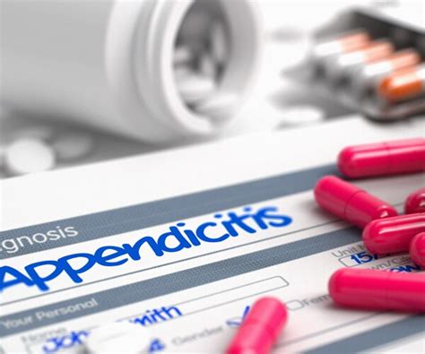 Study Antibiotics Can Help Avoid Surgery For Appendicitis