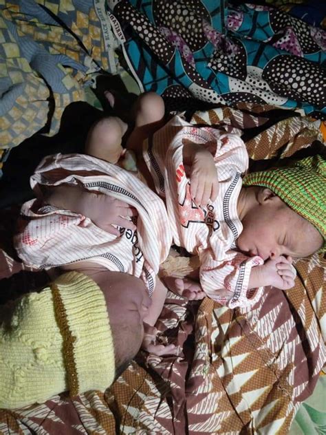 photos woman gives birth to conjoined twins in kaduna informatnews