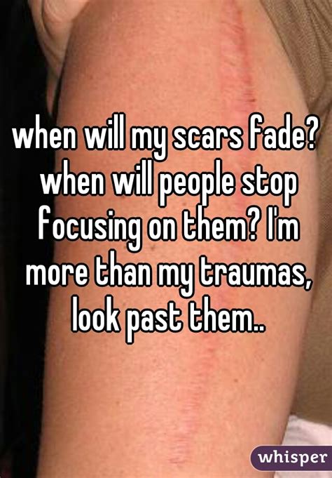 When Will My Scars Fade When Will People Stop Focusing On Them Im