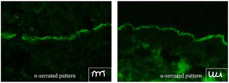 Frontiers Diagnosis Of Autoimmune Blistering Diseases