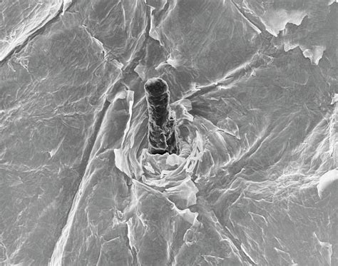 Human Skin And Hair Follicle Photograph By Dennis Kunkel Microscopy