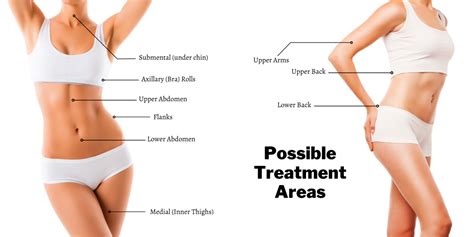 Tumescent Liposuction Beauty Art Centers