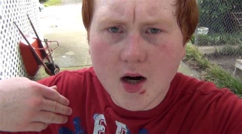 ‘hollywood Hillbillies Youtube Sensation ‘the Angry Ginger Kid To
