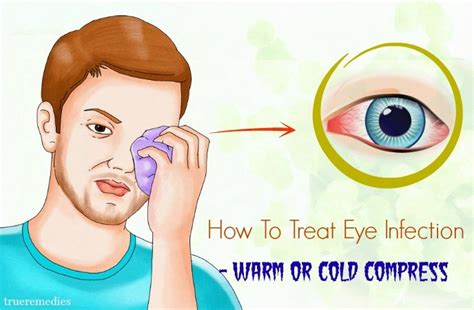26 Effective Tips On How To Treat Eye Infection Naturally At Home