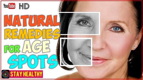 10 Natural Remedies For Age Spots Youtube