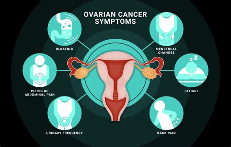 Ovarian Cancer Symptoms Infographic Vector Art At Vecteezy
