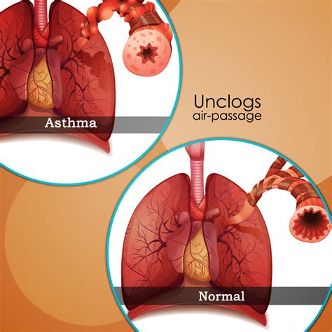 Trusted retailer of health & beauty products since 2001 HEALTHY LUNGS AND A CLEAR RESPIRATORY TRACT WITH ASTHUMIN ...