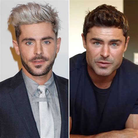 Did Zac Efron Get Plastic Surgery Everything We Know