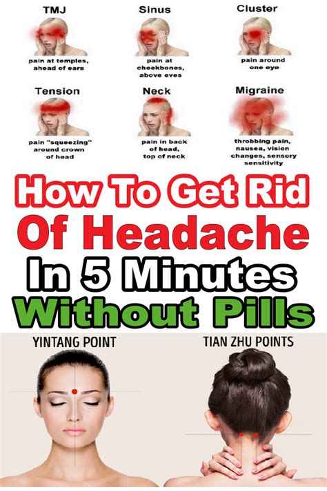 Acupuncture For Migraines Getting Rid Of Headaches Acupressure