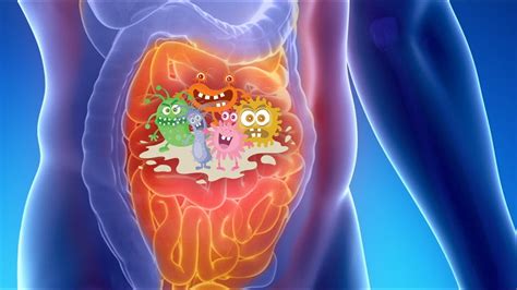 Small Intestinal Bacterial Overgrowth Updates And Clinical Implications Youtube