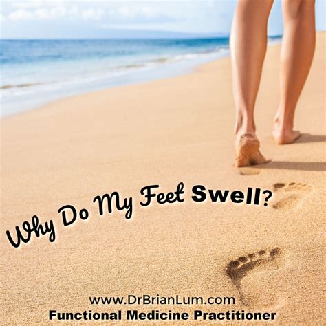 Why Your Feet Swell When Its Hot And How To Fix It