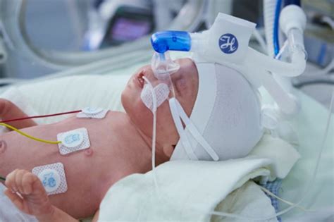 Hamilton C1 Neocomprehensive Care For Newborns In Just One Device
