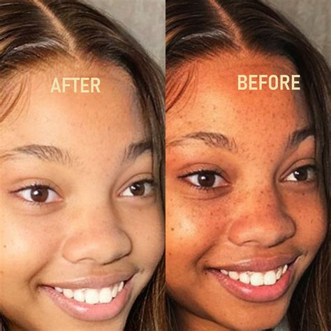Heres How You Can Get That Natural Light Glowing Skin Without Spending