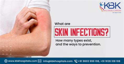 What Is The Best Skin Infections Treatment How Many Types Exist