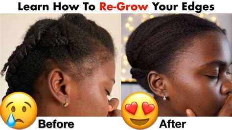 Best Method To Regrow Your Edges Fast Youtube