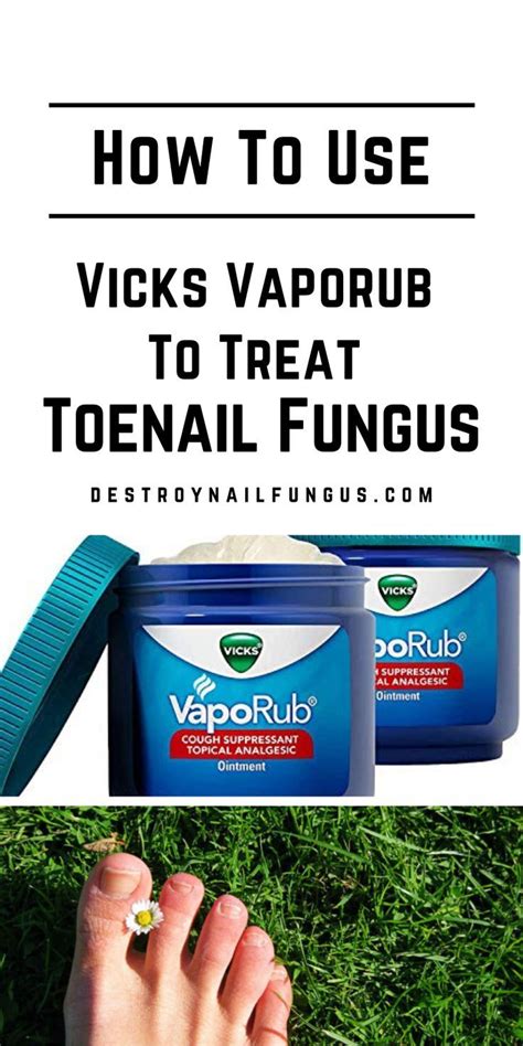 How To Use Vicks Vaporub To Treat Your Nail Fungus Vicks Vaporub Vicks Vaporub Uses Uses For