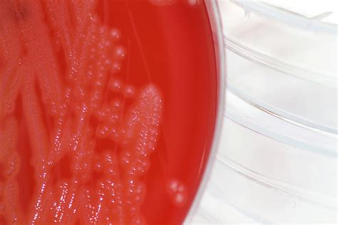 Streptococcus Agalactiae Bacteria Culture Photograph By Daniela Beckmann Pixels