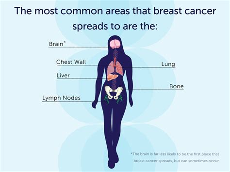 how fast does breast cancer spread lymph nodes harness explains the purpose of lymph nodes in