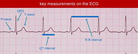 Why The QT Interval Matters Straight A Nursing